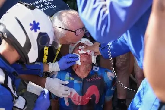 Tour de Francia: Brutal accidente de Einer Rubio obliga a su retiro